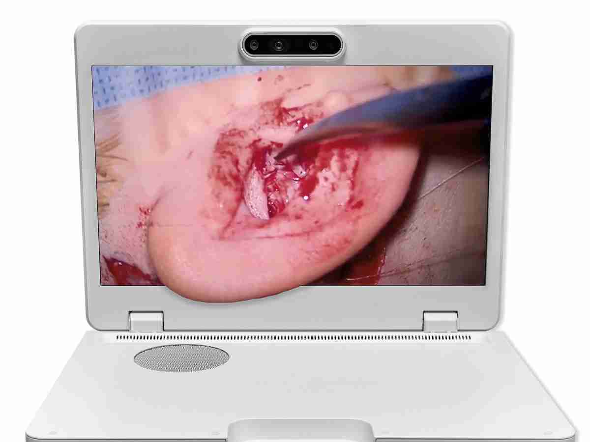 达擎之＂Heads-up 3D显微手术显示系统＂，，整合4K裸眼3D显示及眼球追踪系统，，，具备快速追踪人眼移动位置功能，，，，减轻医师长时间维持固定姿势的负担，，，，让医师能有更宽广清晰的3D立体视野及更舒适的姿势来执行手术。。。